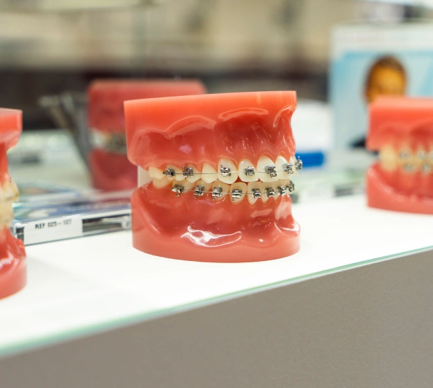 Braces