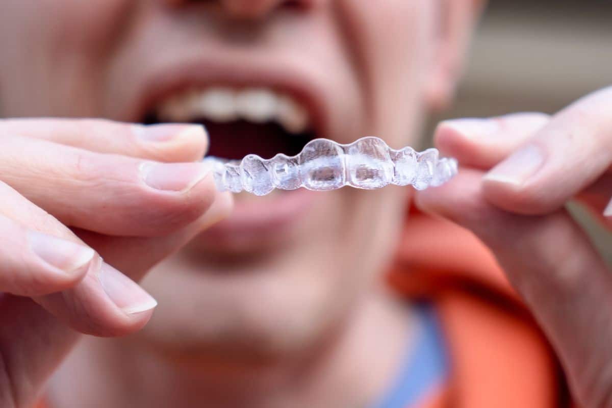 invisalign aligners